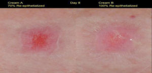 skin resucitation factor before and after image